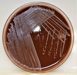 Neisseria on Chocolate Agar by Sarah Sletten