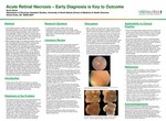 Acute Retinal Necrosis: Early Diagnosis is Key to Outcome